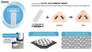 VẬT LIỆU CẤY GHÉP NHÂN TẠO HOLOSMEDIC MESH 3 792198795 122168121254976618 414335177750982338 n