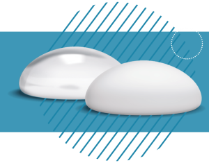 Túi ngực CereForm Classic Gel